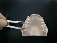 Medição do dente 16